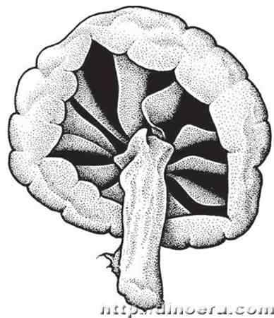 Archaeomarasmius leggeti