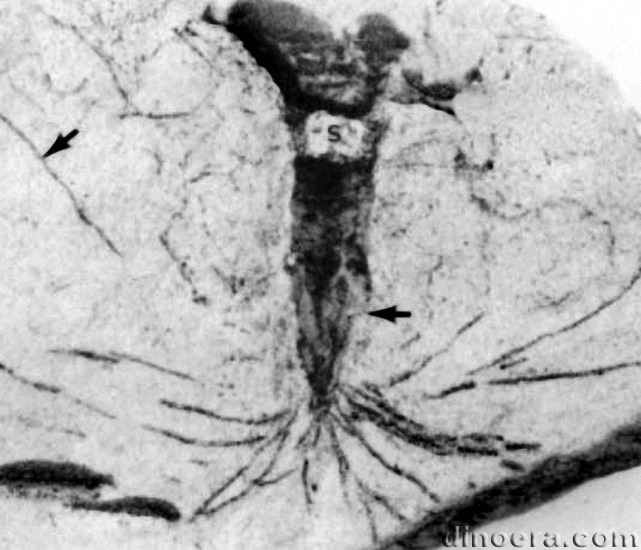 Nathorstiana arborea 06 cc