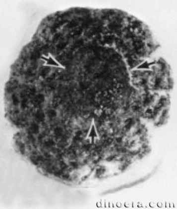 Nathorstiana arborea 12 cc