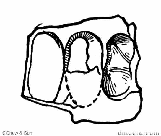 Paoteodon huanghoensis