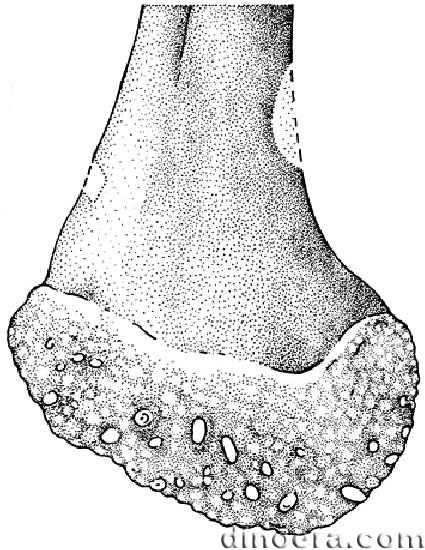 Pleuromeia rossica 33 cc