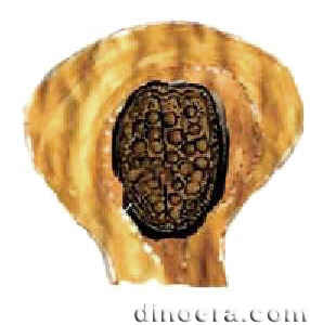 Pleuromeia sternbergii 24 cc