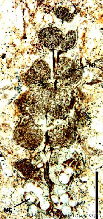 Selaginellites crassicinctus