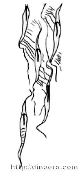 Sublepidodendron fallax